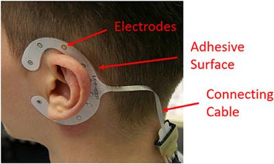 Measuring Correlates of Mental Workload During Simulated Driving Using cEEGrid Electrodes: A Test–Retest Reliability Analysis
